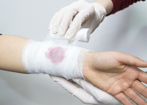 How to stop bleeding? Learn the survival technique