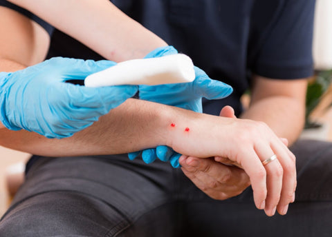 How to deal with snake bites on trails and campsites?